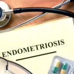 Endometriosis concept. Book with stethoscope and pills.