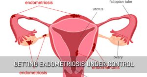 endometriosis getting hormonal
