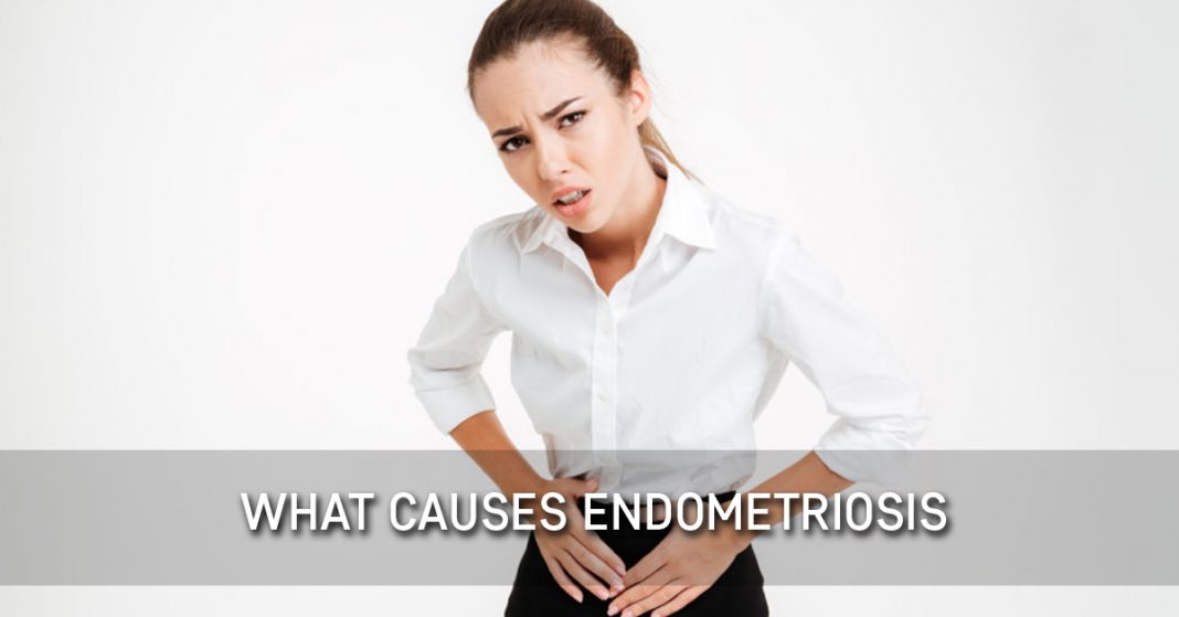 What Causes Endometriosis | ThisIsEndometriosis.com