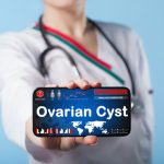 ovarian cyst 2