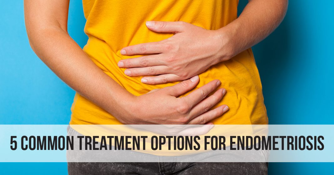 5 Common Treatment Options for Endometriosis
