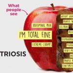 Endometriosis-Apple-1-1