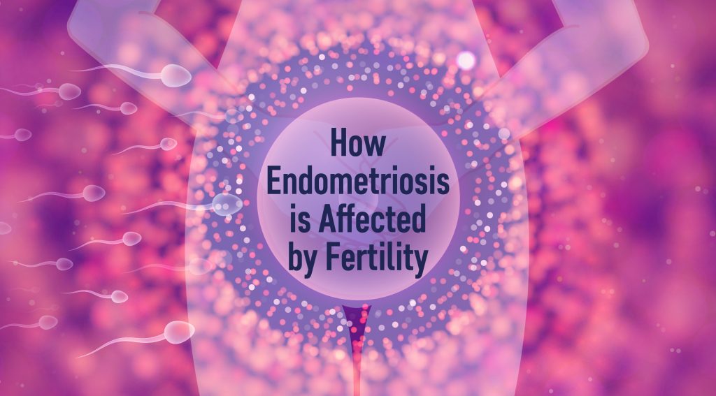 How Endometriosis is Affected by Fertility - ThisIsEndometriosis.com