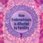 How Endometriosis is Affected by Fertility 696px x 385px Header-01-01